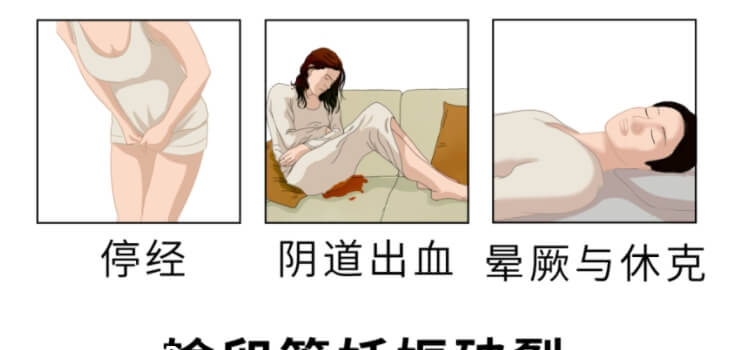 宫外孕的早期症状