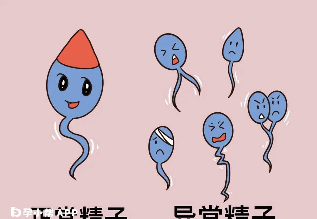 畸形精子的外观