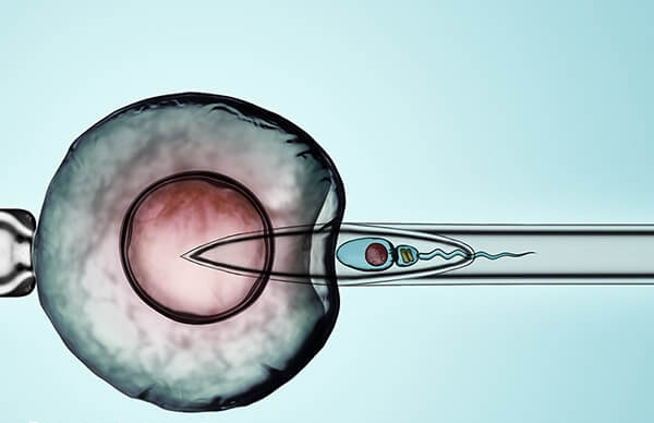 卵子质量影响补救ICSI的受精率