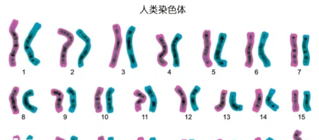 人类数模色体核型