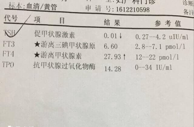 促甲状腺激素参考值