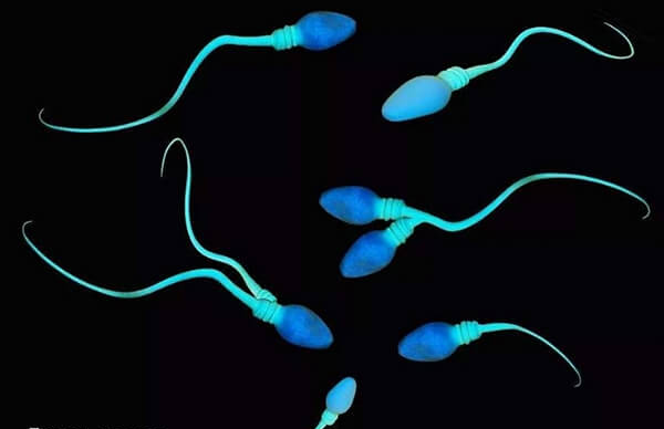 精子畸形会影响生育