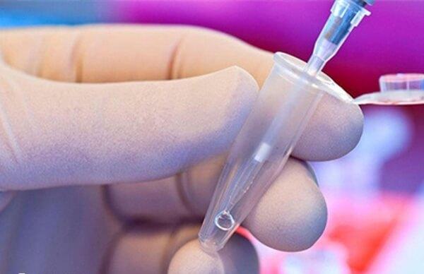 取卵后小腹疼痛时间因人而异