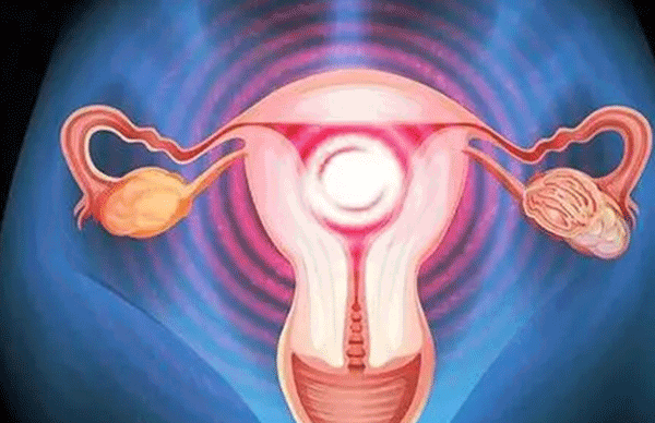 子宫内膜5mm有点薄