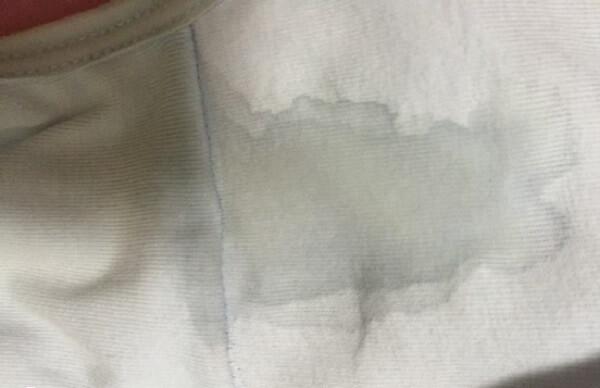 促排期间分泌物增多很正常