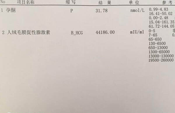 孕酮值过高会影响内膜容受性