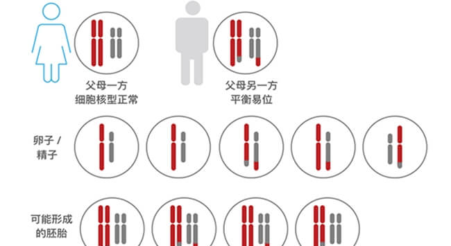 染色体平衡易位遗传规律