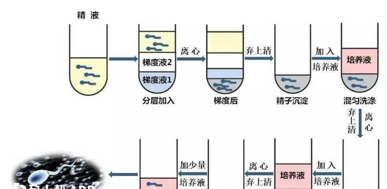 密度梯度离心法精液处理过程
