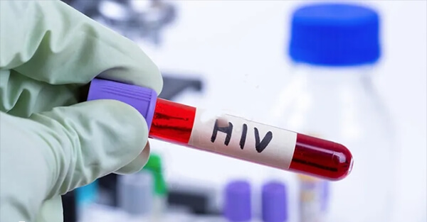 HIV携带患者是不可以在国内做试管婴儿