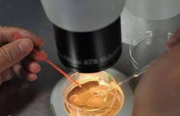 hiv男性做试管洗精不意味着百分百安全