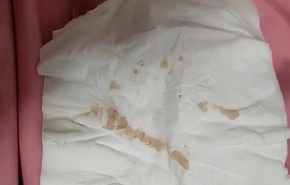 阴道出血可能是胚胎着床了