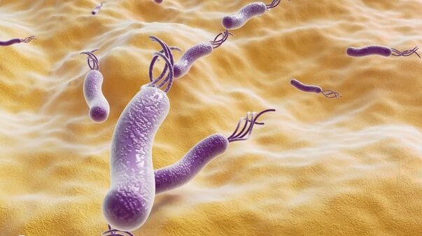 抗心磷脂IgM抗体是一种自身免疫抗体