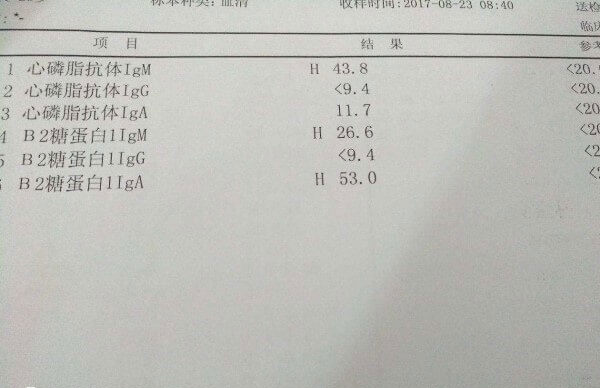 抗心磷脂抗体需要治疗后才能做试管