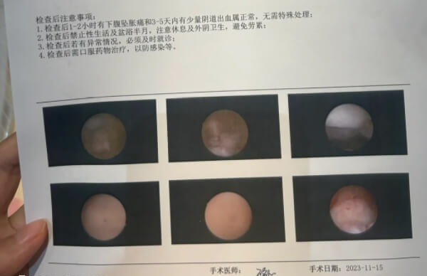 试管婴儿是现代医学技术的一大进步
