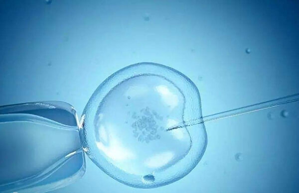 试管婴儿是一项高风险高技术难度的治疗手段