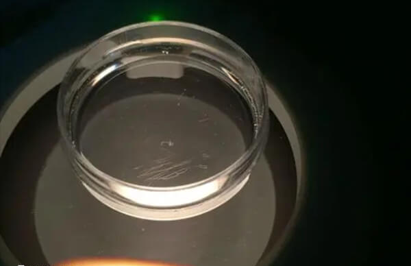 腹腔镜手术是一种微创治疗方法