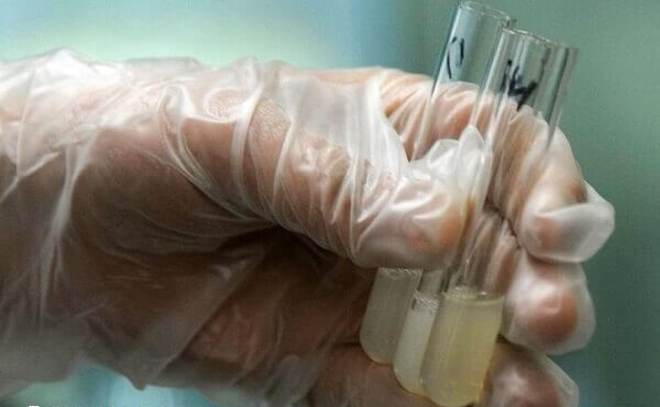 男性做试管前需要做精液检查