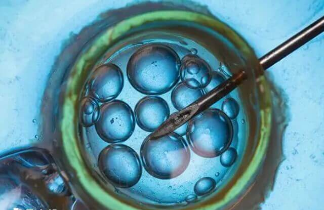 取卵后3到5天可以进行鲜胚移植