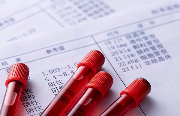 amh值为0.48多代表卵巢储备不足