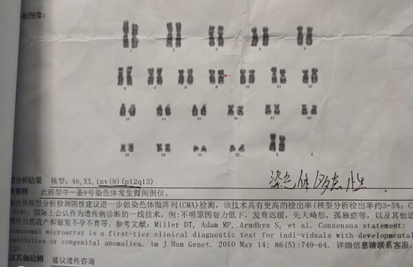 9号染色体是人类的23对染色体之一