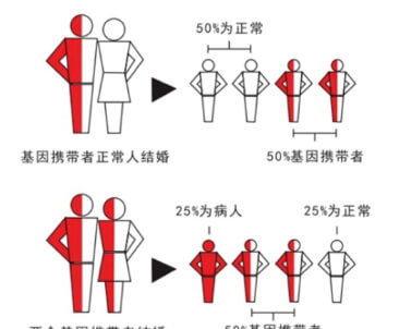 地中海贫血遗传模式