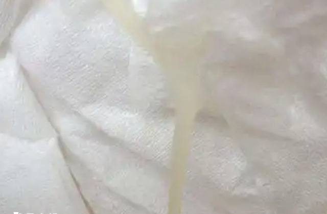 白带增多可能会影响备孕
