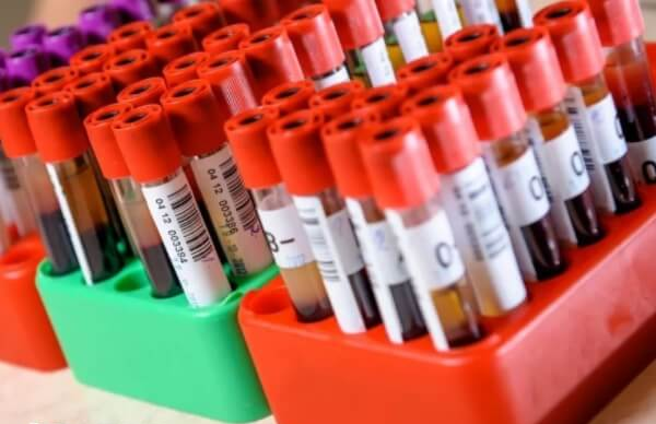 单纯IgG阳性不会传染