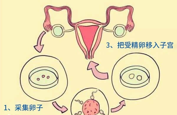 四代试管没有运用到临床