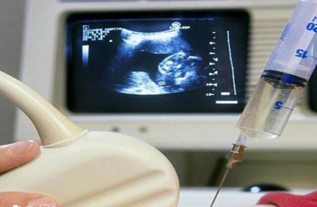 刚生完孩子的女性一般处于哺乳期阶段