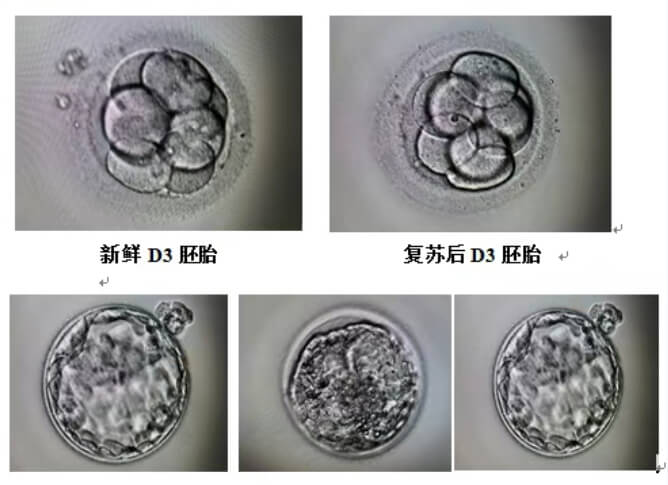 冷冻胚胎复苏后的胚胎