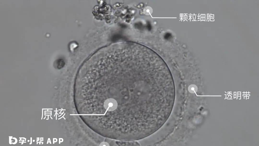 2PN是正常受精的胚胎