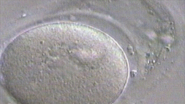 卵子透明带可以起保护作用