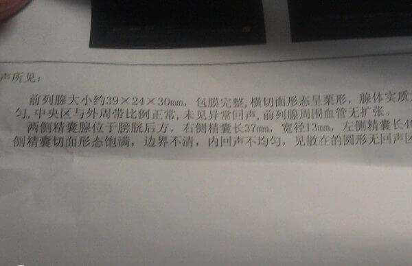 胸透对精子的质量是会产生一定程度上的影响