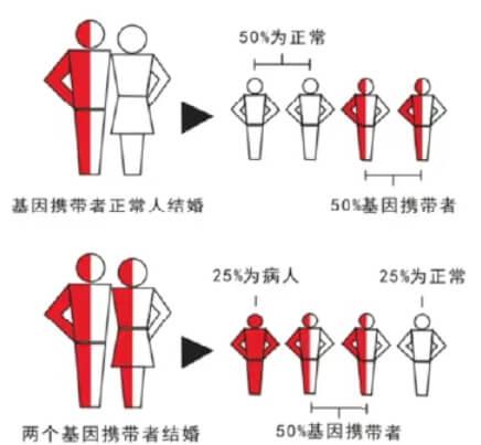 地贫是一种基因病