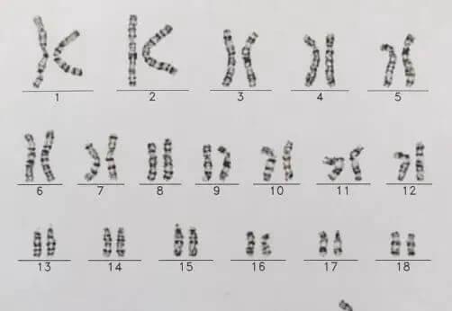 正常男性的染色体报告