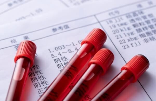 同房后14天可以抽血验孕
