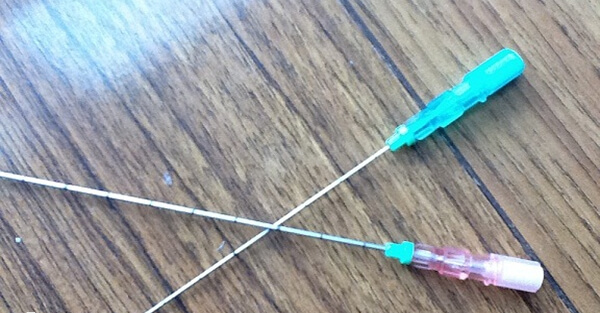 取卵针是一种医疗器械