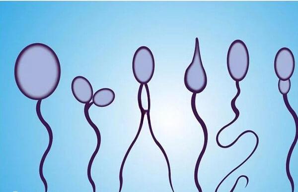 精子畸形率高不代表不能生