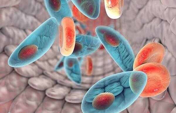 弓形虫的检查可能会因为不同的检测方法