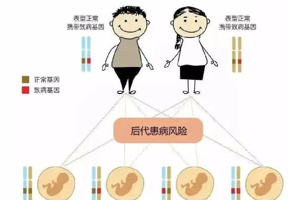 甲基丙二酸血症后代患病风险