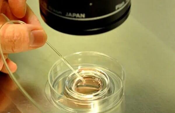 第三代试管婴儿要进行囊胚活检