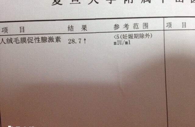 腹膜后妊娠无特异性临床表现