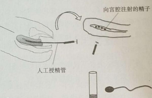 人工授精成功率不高