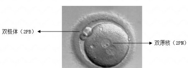 2pb受精卵