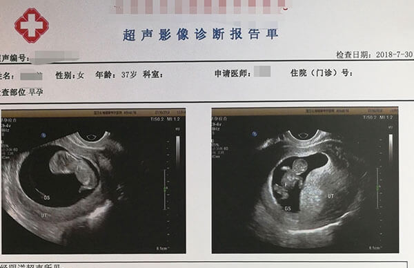 les可到美国做试管生子