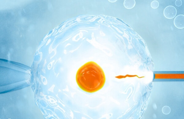 试管婴儿费用影响因素