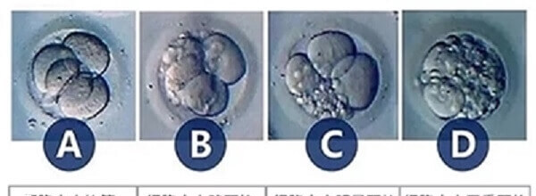 胚胎划分等级