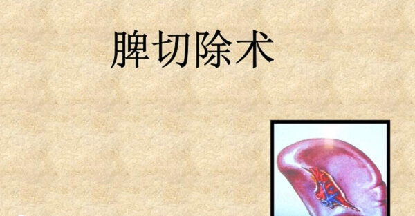 脾切除术