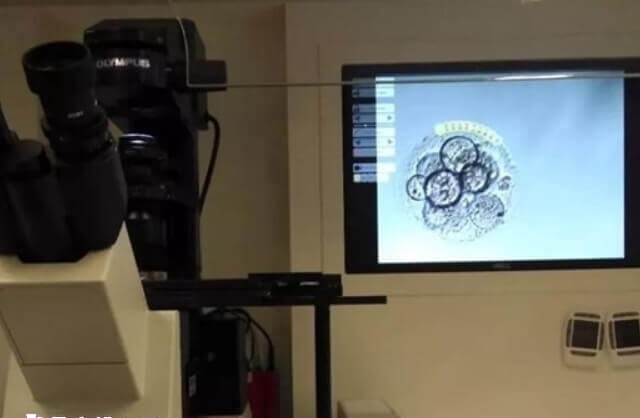 激光法的优势是操作时间短