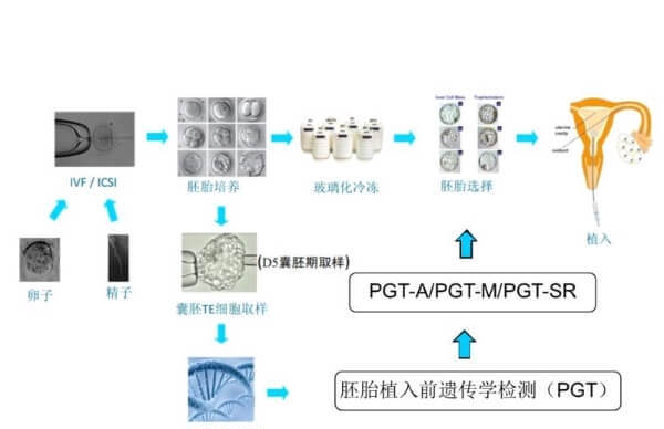 染色体异常可以做三代试管